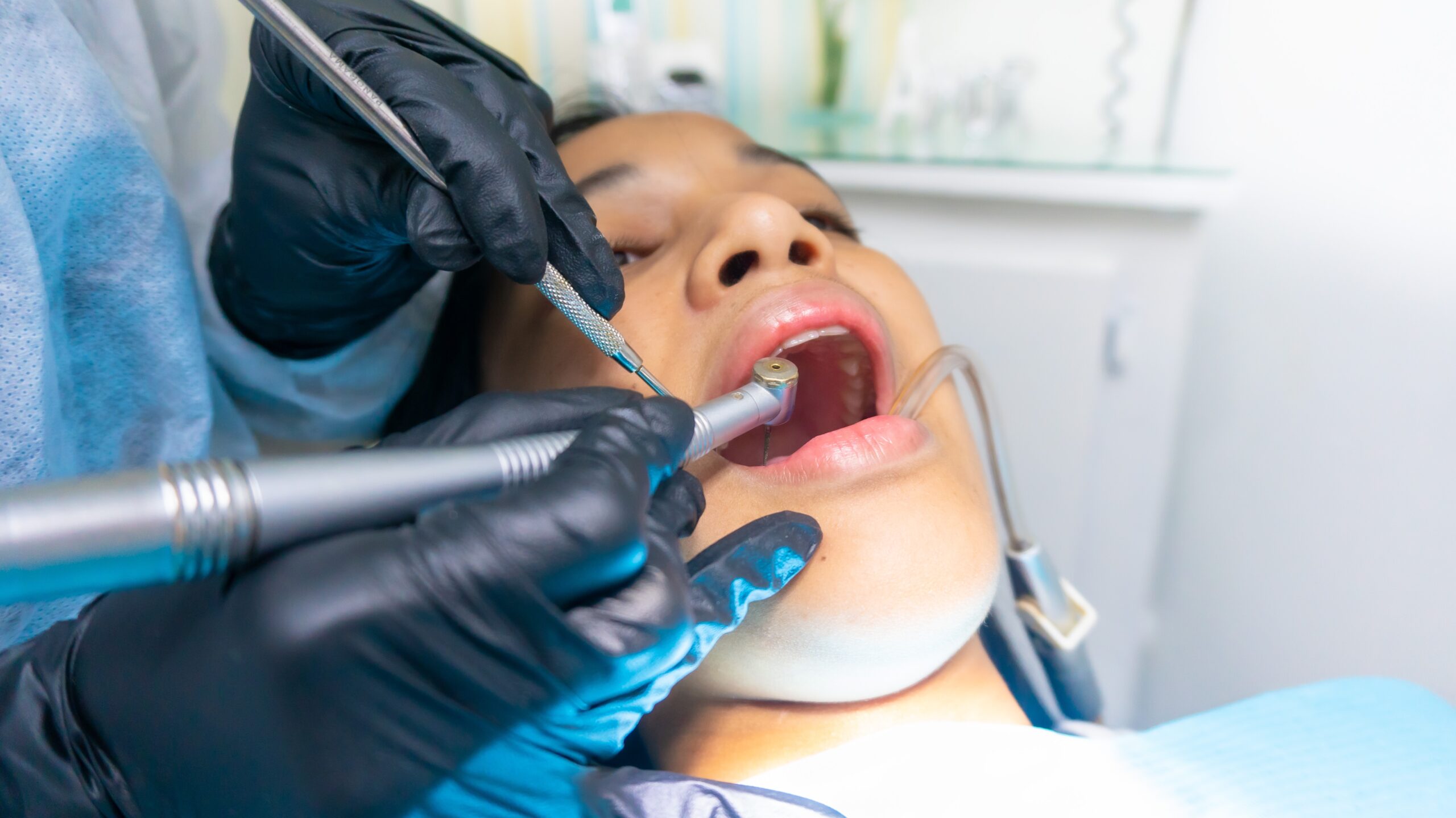 Broken Tooth Repair in Ladson SC - Experienced Emergency Dentist Open